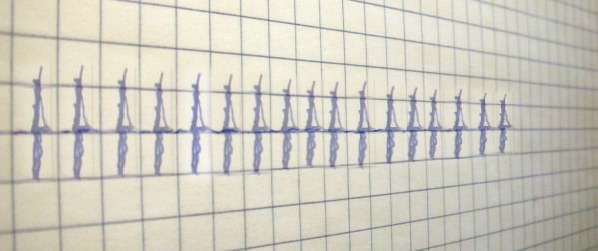ink marks