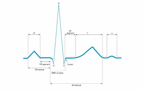 P wave