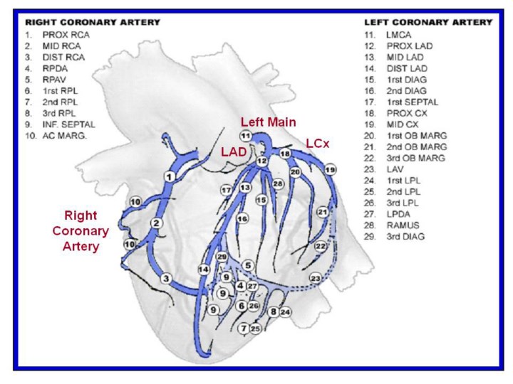 3 Alderman EL Stadius ML The Angiographic Definitions Of The Bypass 